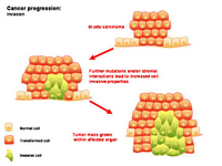 Cancer progression - Invasion PPT Slide