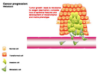 Cancer progression - Metastasis PPT Slide