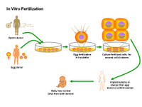 In vitro fertilization PPT Slide